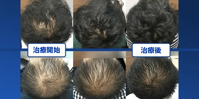 初月888円〜 始めやすい料金設定